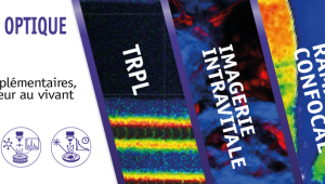 Techniques avancées de Microscopie