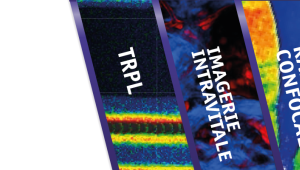Techniques avancées de Microscopie